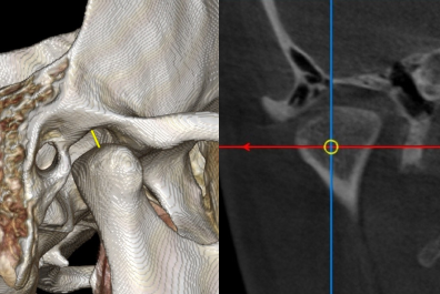 3D CT